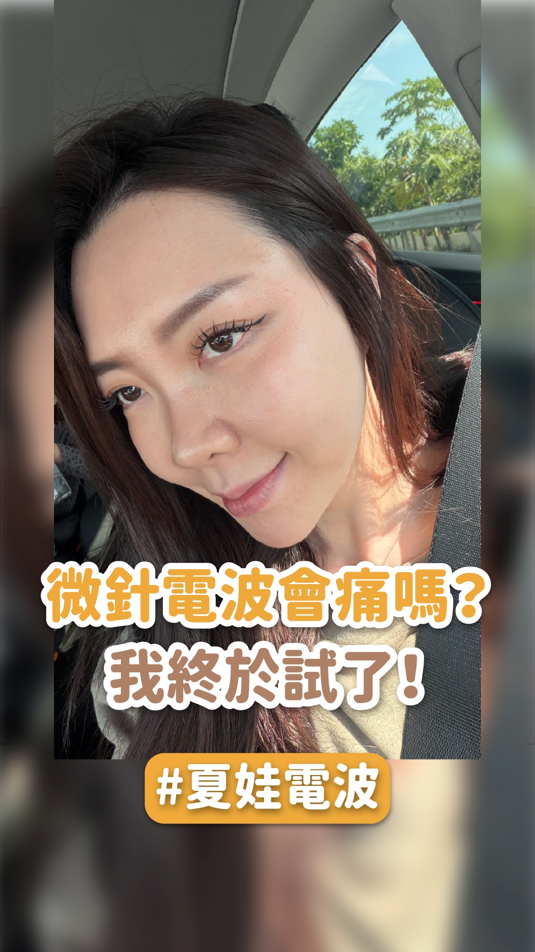 微針電波真的會痛嗎？我終於試了夏娃電波！