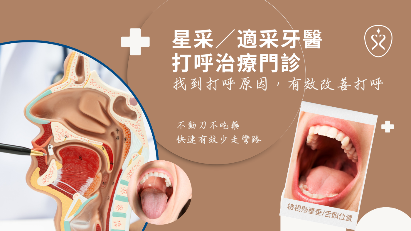 星采／適采牙醫打呼治療門診｜找到打呼原因，有效改善打呼，不動刀不吃藥、快速有效少走彎路