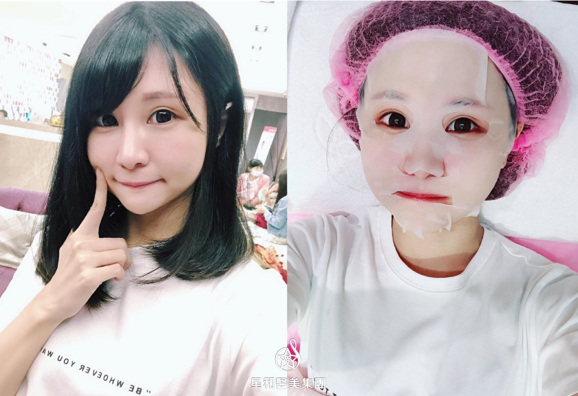 【皮秒雷射(廣特探索皮克雷射系統)】