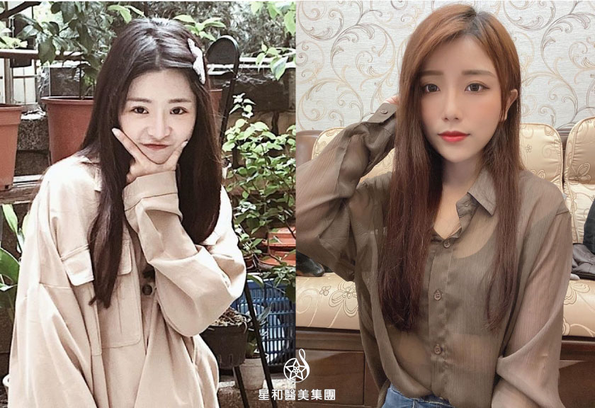 【活力滿點滴】