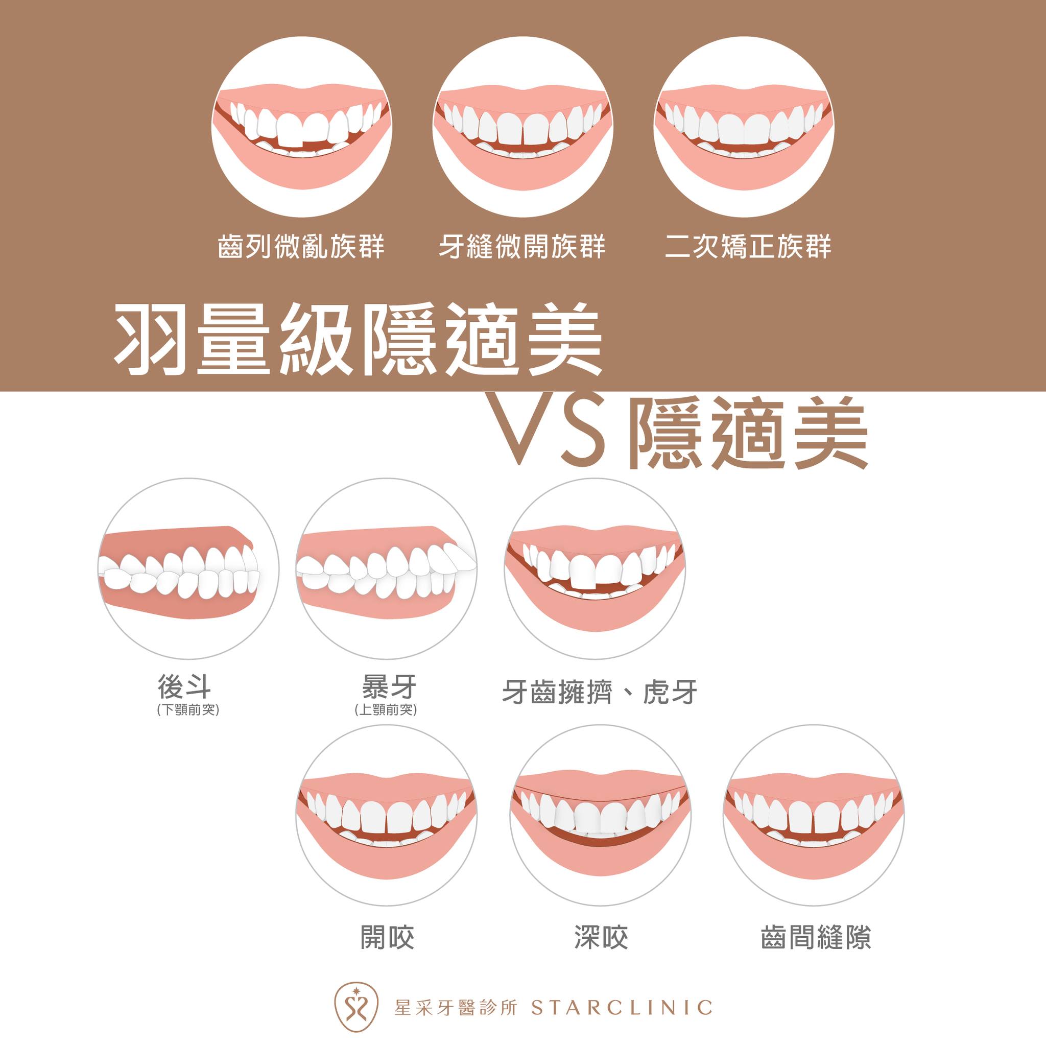 隱適美比較