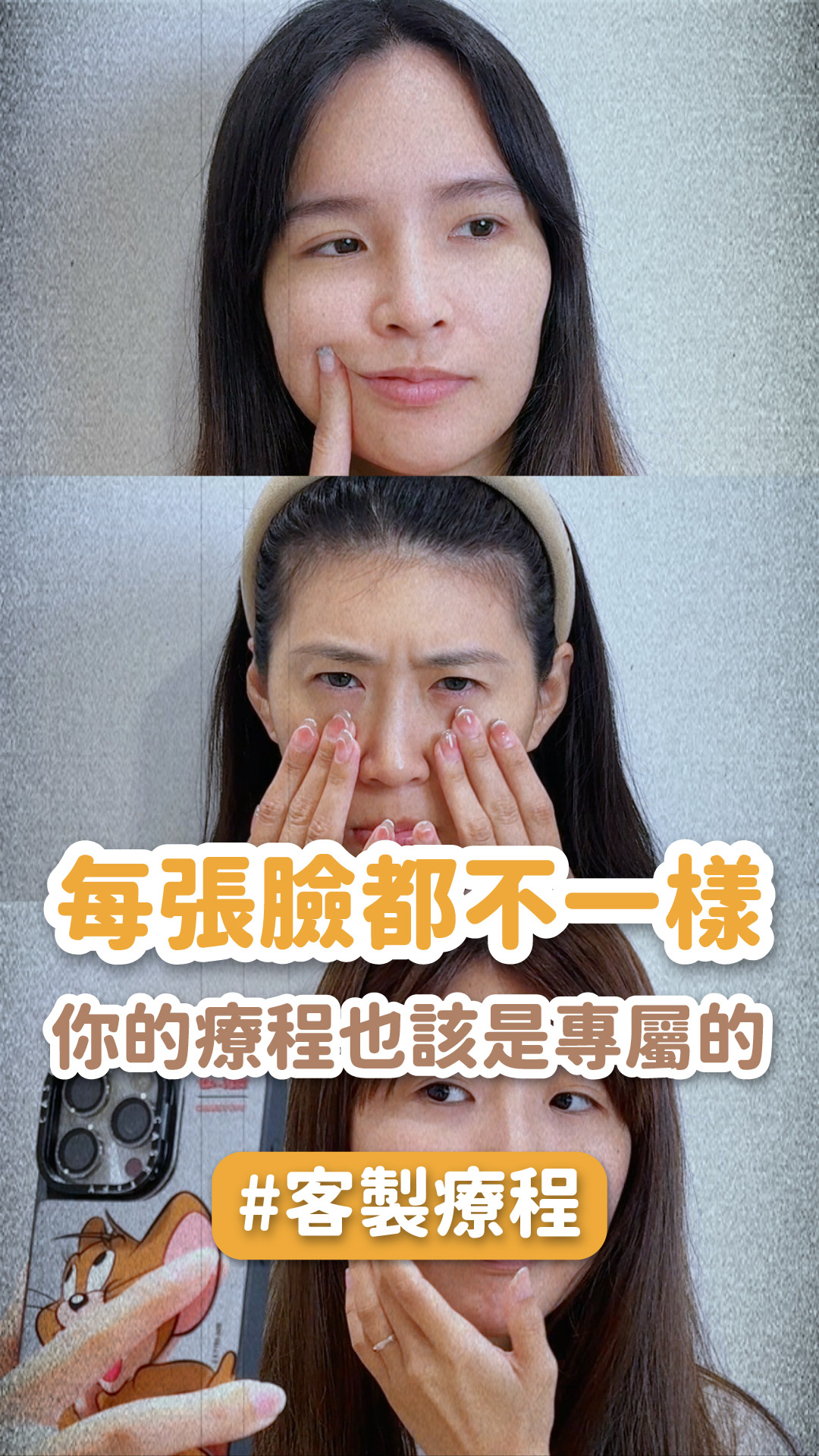 每張臉都不一樣，你的療程也該是專屬的✩