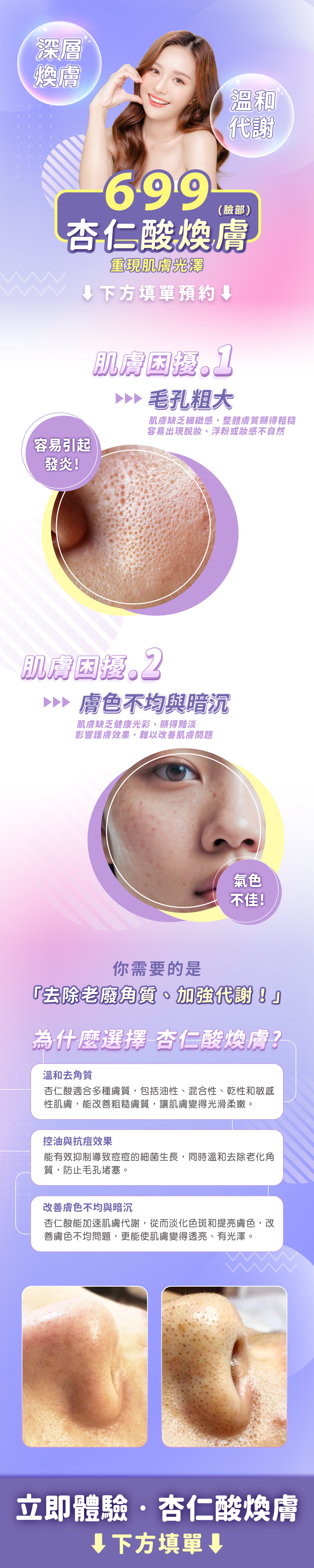 行銷-杏仁酸(臉部)699留單頁廣告