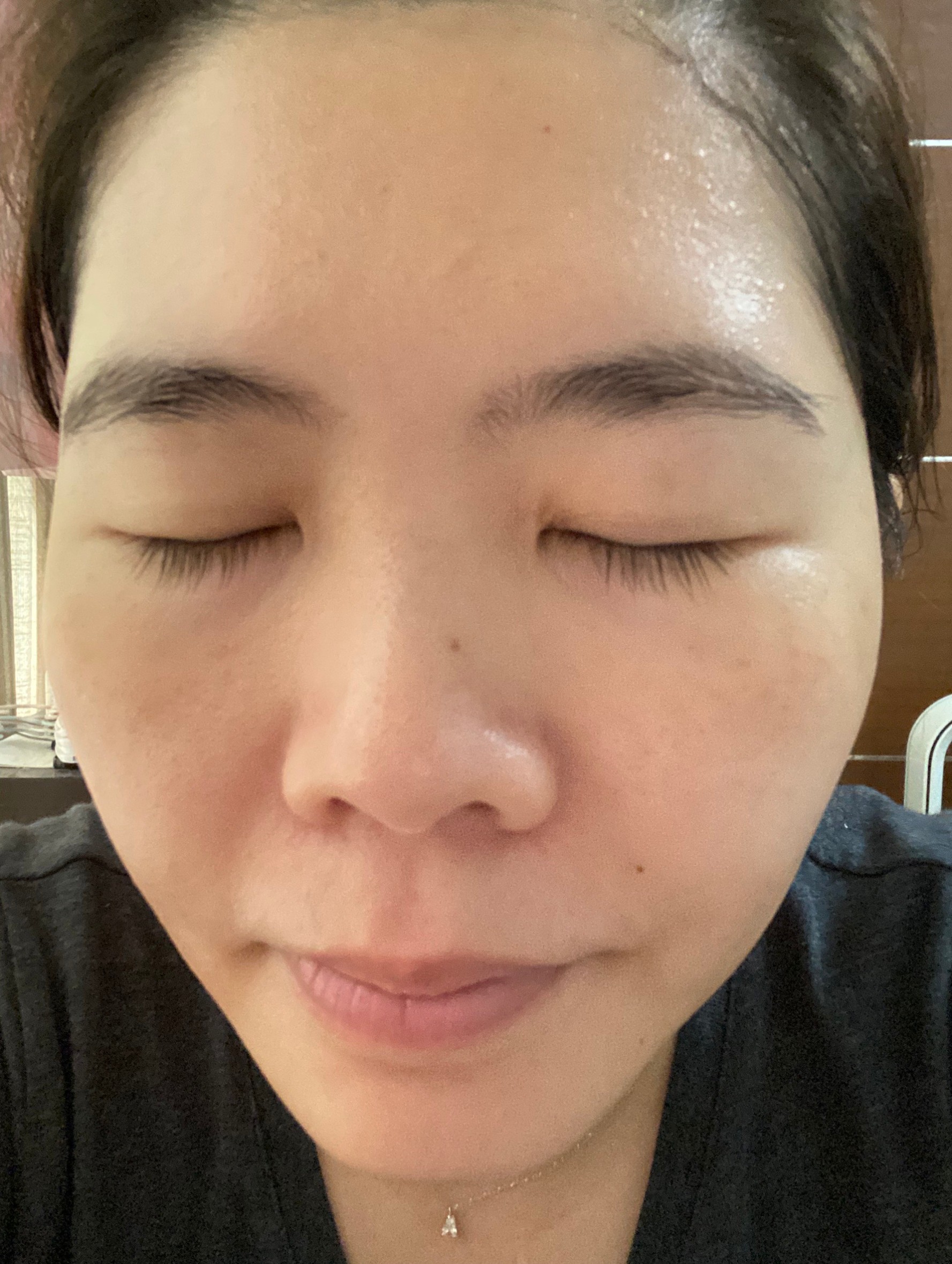 修秘水光Day8退瘀透亮完美成果