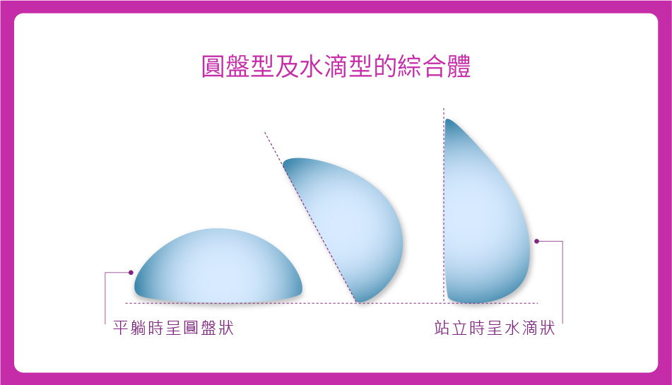 Motiva波力媚隆乳的4D流動膠體