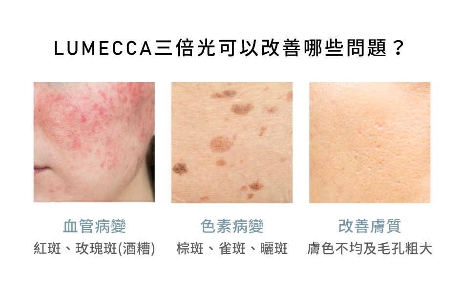 LUMECCA三倍光可以解決什麼問題?