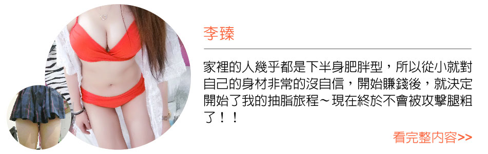 超音波抽脂/威塑抽脂的美麗分享