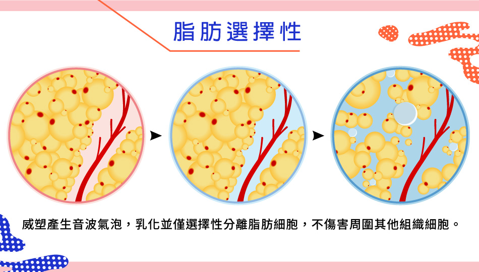 威塑抽脂,脂肪的選擇性