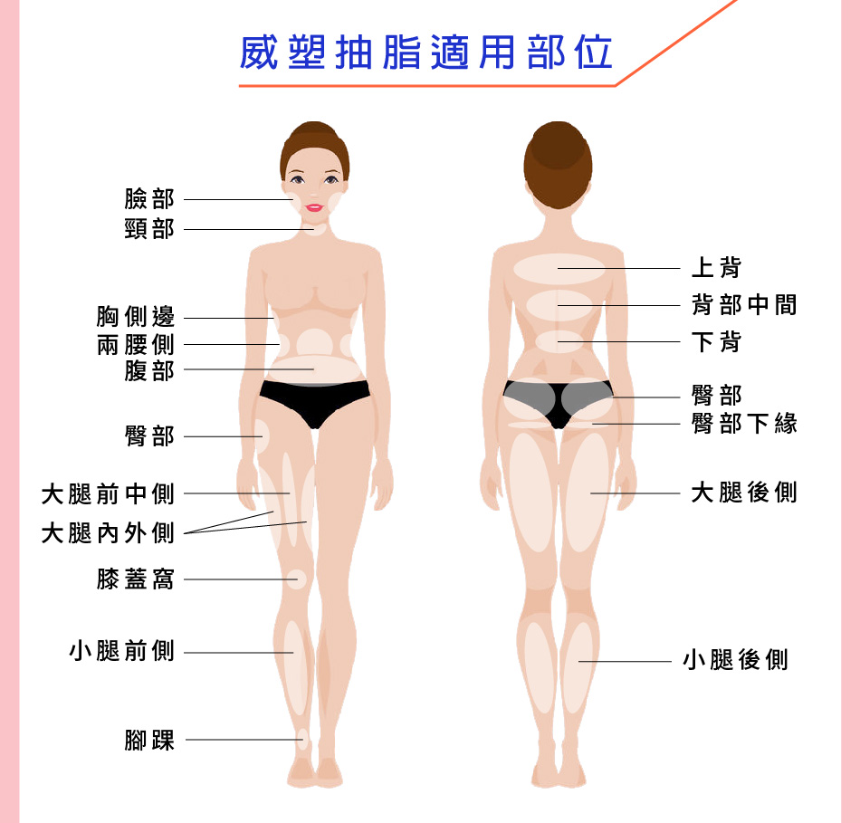 威塑抽脂的適用部位