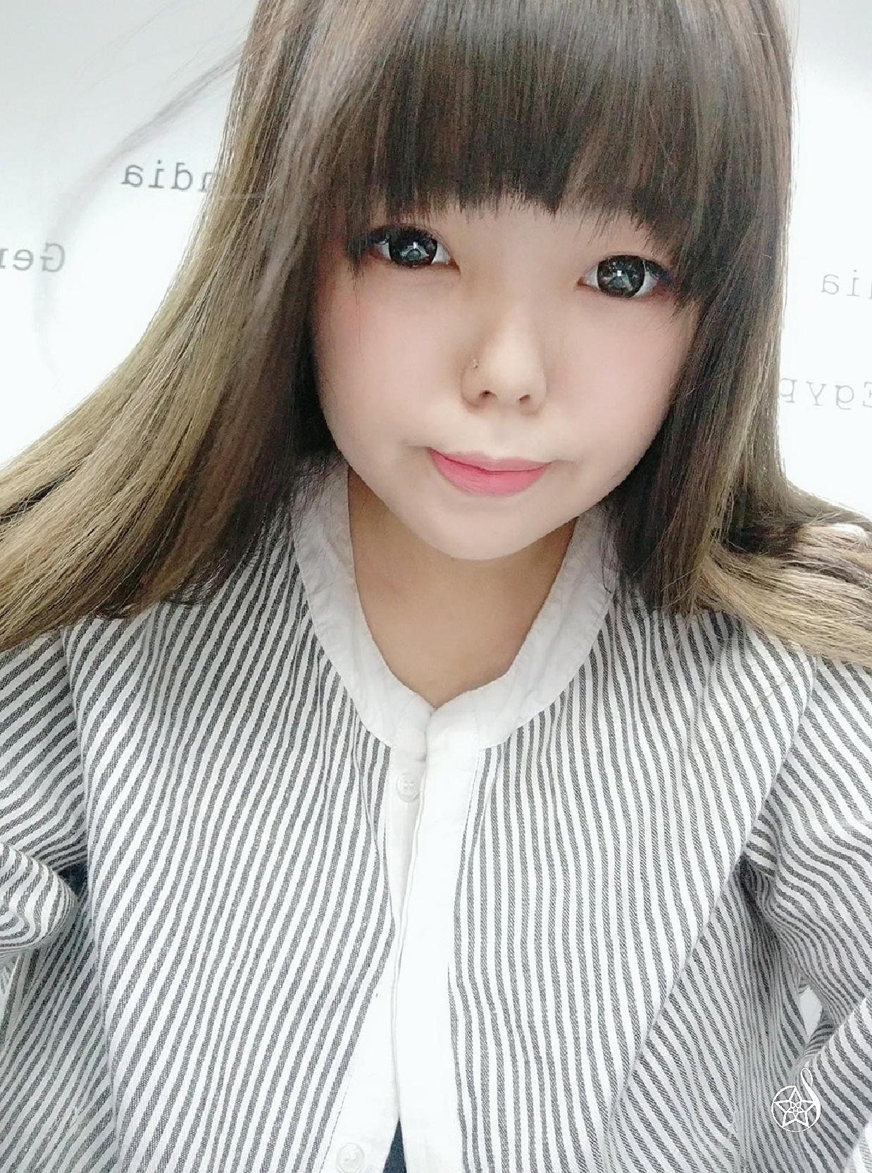 雙眼皮手術前後差異分享