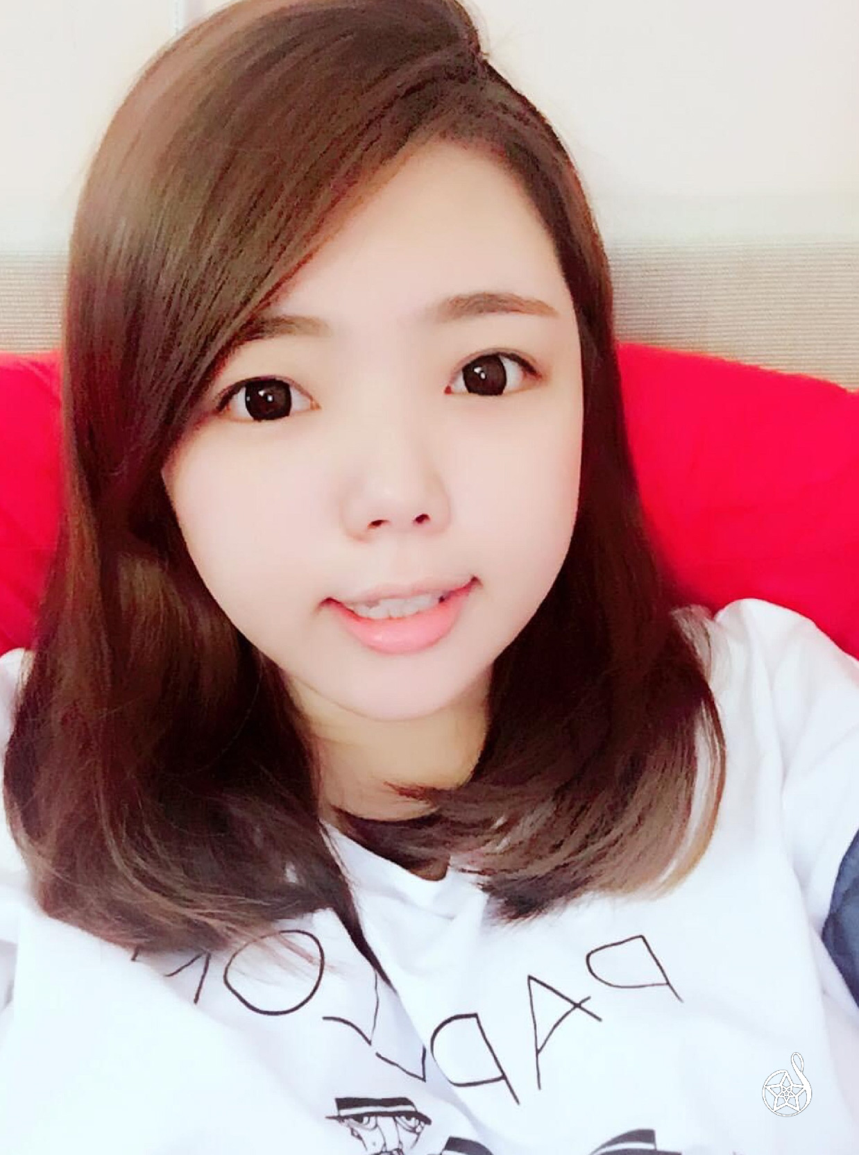 雙眼皮手術前內雙眼型紀錄