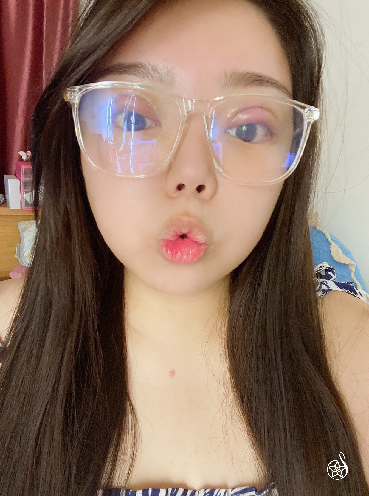 雙眼皮手術術後戴眼鏡直播紀錄