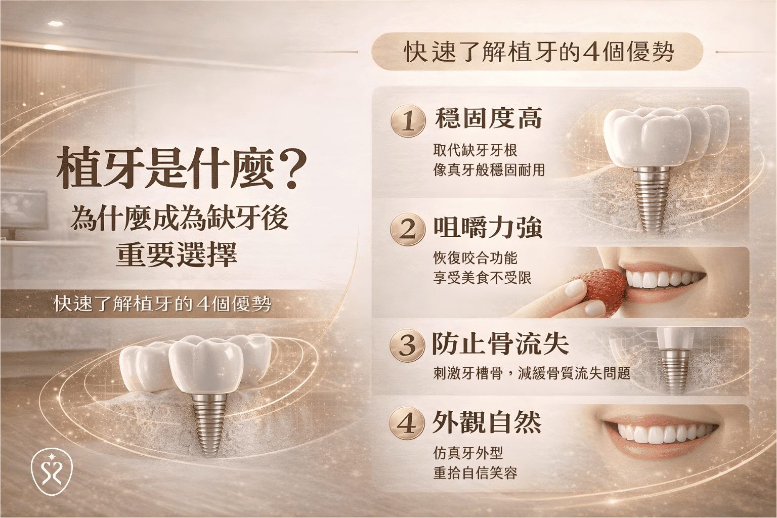 植牙是什麼？為什麼成為缺牙後的重要選擇