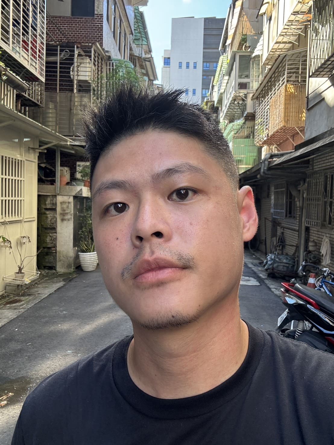 夏娃電波術後隔日臉部無明顯痕跡